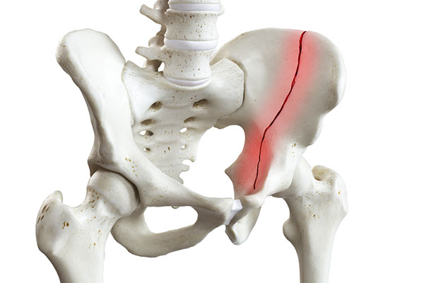 Pelvis Asetabulum Cerrahisi