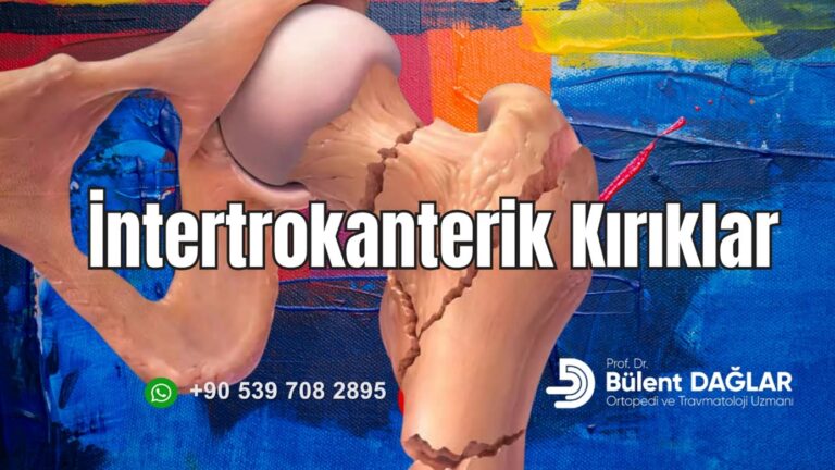İntertrokanterik Kırık