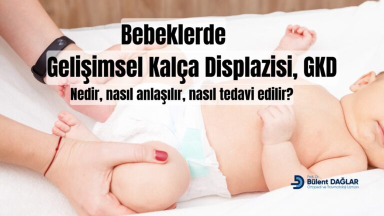 Bebeklerde kalça çıkığı nasıl anlaşılır?